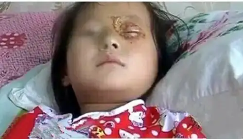 【惊悚】洗衣机突然爆炸!6岁孩子眼睛炸瞎!冬天羽绒服千万别这样洗!