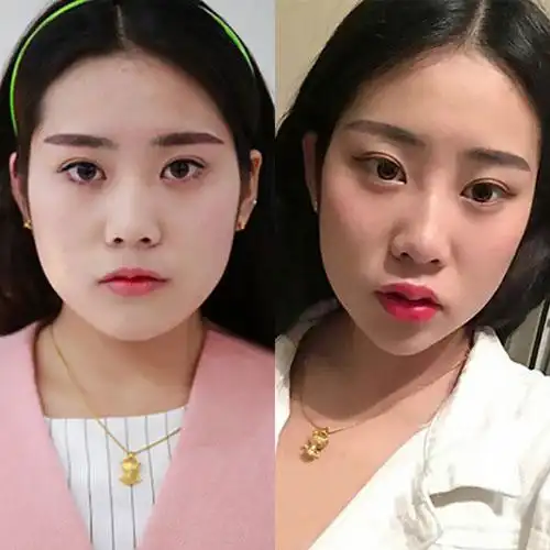 大饼脸和圆脸的区别是什么 大饼脸瘦下来是什么脸