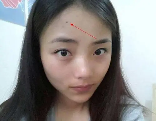 人生九大劳碌痣太要命长得越多命越苦你有几颗