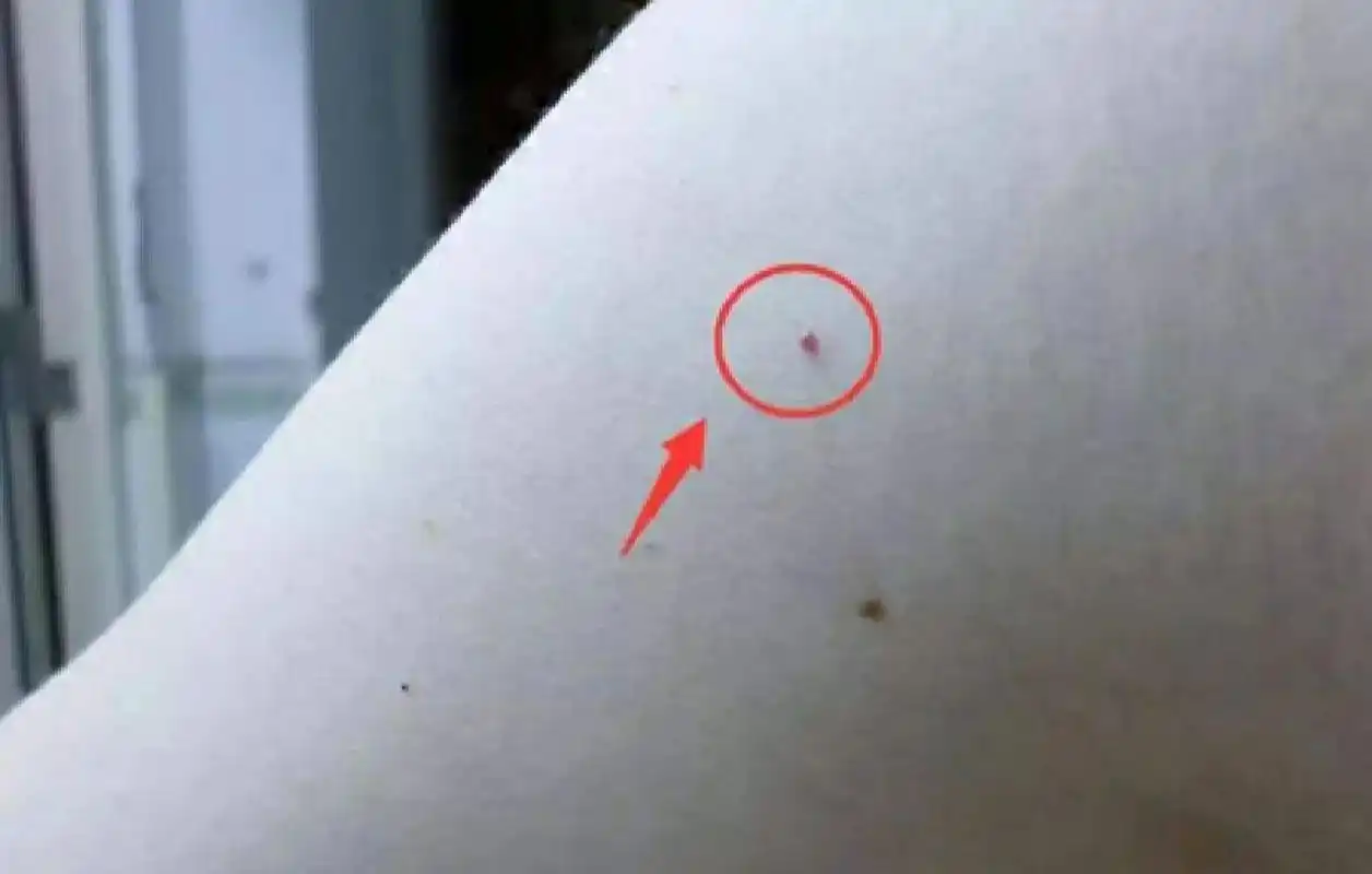 1 朱砂痣的出处 "朱砂痣",出于张爱玲小说《红玫瑰与白玫瑰》,"也许每