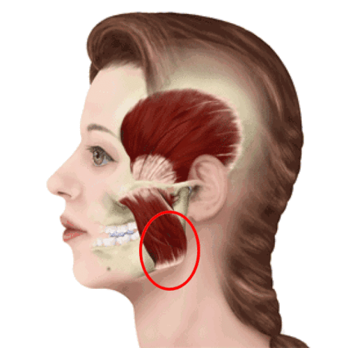 玻尿酸和肉毒素可以一起使用?