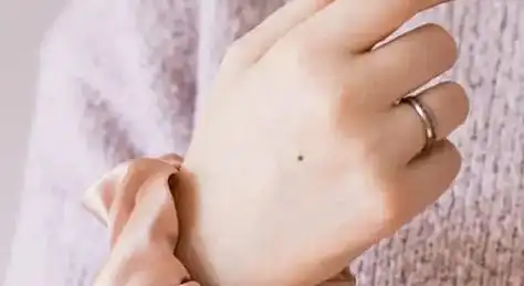 手背有痣的女人图解,手背有痣的女人图解大全