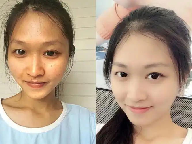 王洋美白前后,真的让我很羡慕!