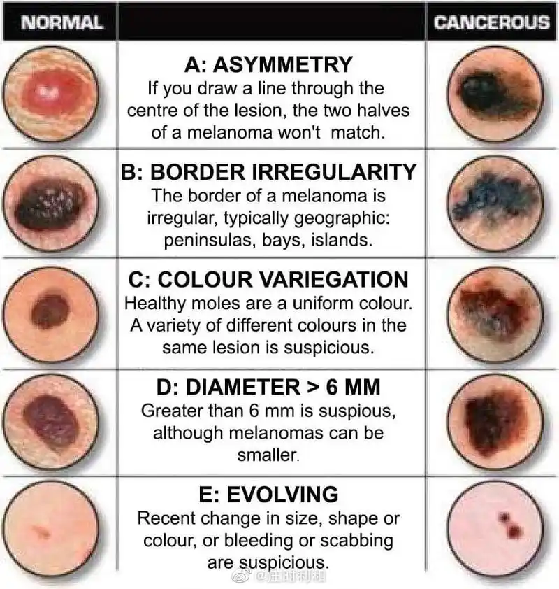 中国好声音第二季亚军张恒远去世
