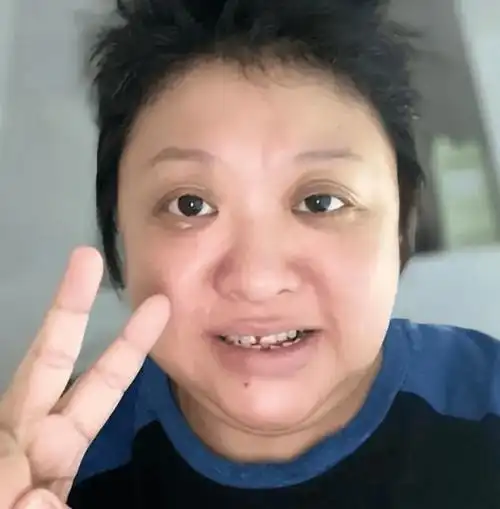 韩红暴瘦40斤颜值飙升,圆脸变尖脸,眼睛大一圈,丸子头配牛仔装时尚又