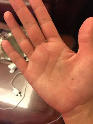 手心有颗痣～～～也许我注定独单一人{:boy-cry:}