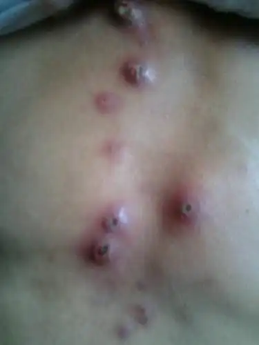 这是什么,长在胸前