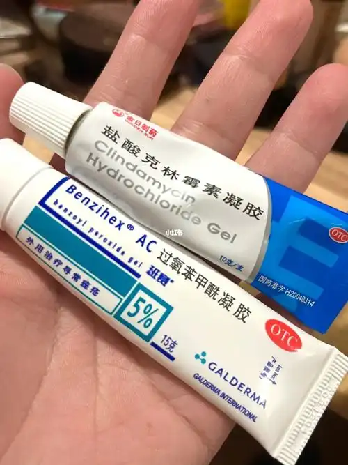 痤疮药膏