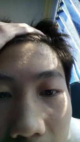 请问我头上的小疤可以整走吗?如果整走大概几多钱?