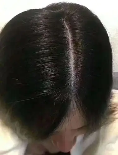 白发转黑效果对比