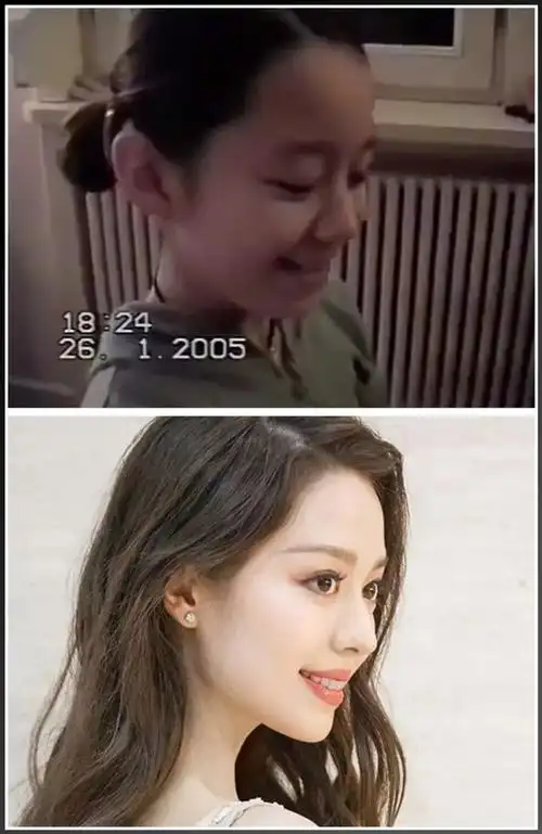 点婴儿肥,所以下巴的线条不够明显95吉娜小时候的视频就能看得出来