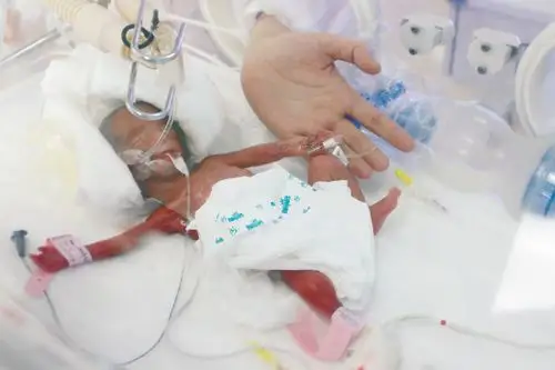 综合 沈阳日报  6月1日,她怀孕18周了,到阜新当地一家医院做常规孕检.