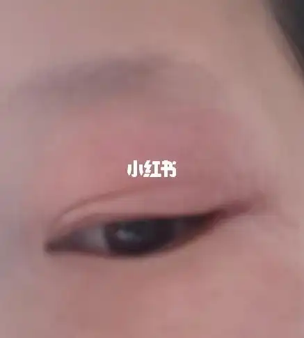 眼睛过敏 的姐妹可以借鉴一下