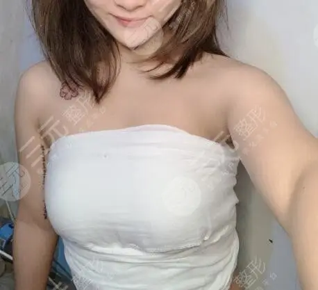 c罩杯多大什么手感真人假体隆胸手感体验