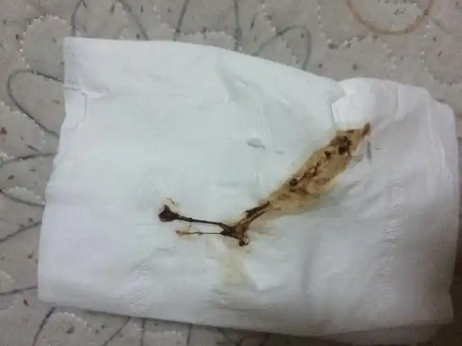 顽强!怀孕白带褐色"口是心非"-第1张图片-影驰网