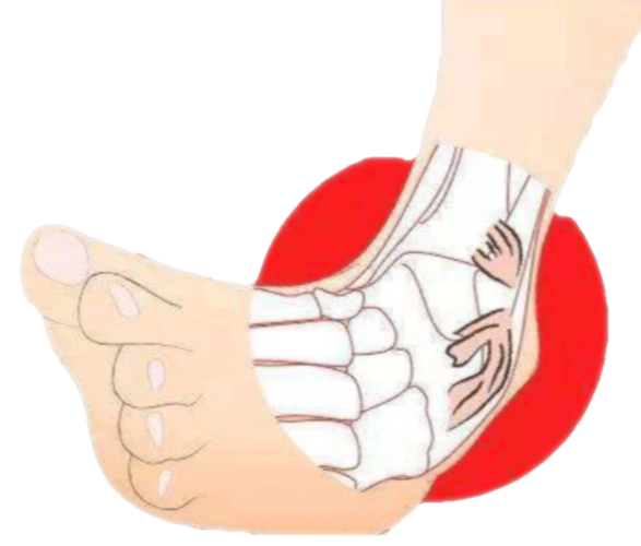 军训小贴士跌打损伤我有招