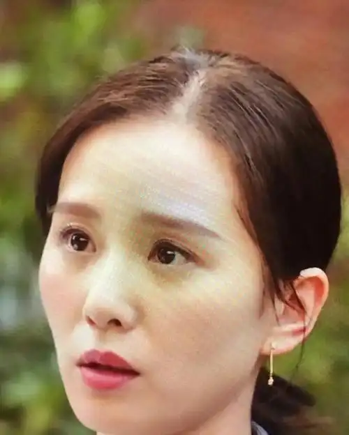 改善刘诗诗的老气横秋"木偶纹",有好的办法吗?