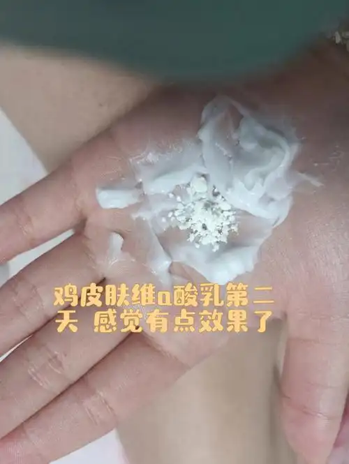 大家看看 是不是我看错了#去鸡皮肤大作战  #鸡皮肤  #鸡皮肤怎么消除