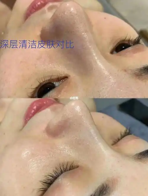 深层清洁皮肤毛孔