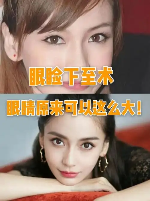 下眼睑下至原来眼睛还可以这么大!