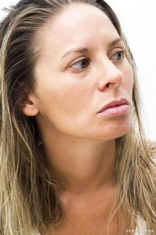 造成皮肤暗沉的三个原因,你知道吗