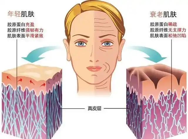 因为smas筋膜层是支撑面部皮肤的关键层次,也被称为"面部支架",是皮肤