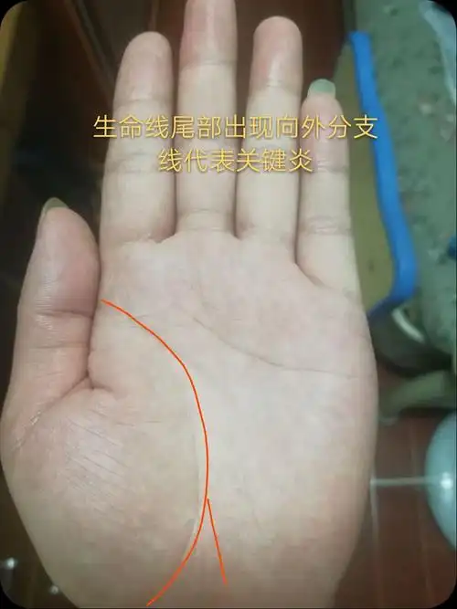 生命线尾部出现向外分叉