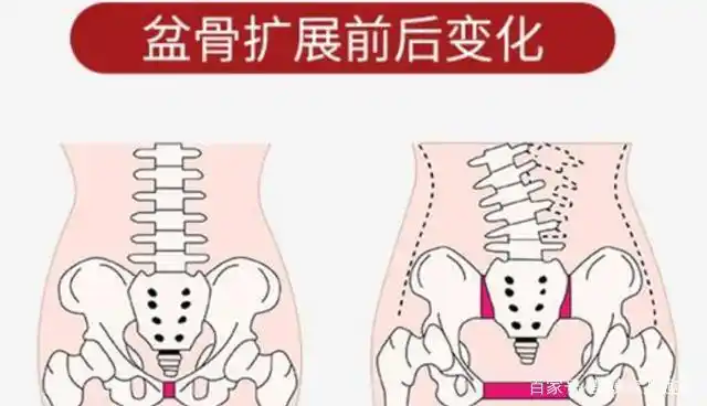 女人生没生过孩子,看是"少女胯"还是"妈妈胯"便知,隐藏不住