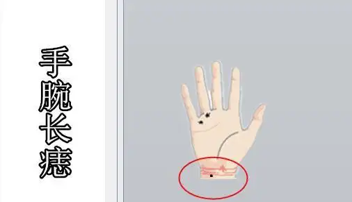 身体5颗巨富痣一个发家一个兴业老了有钱也有福