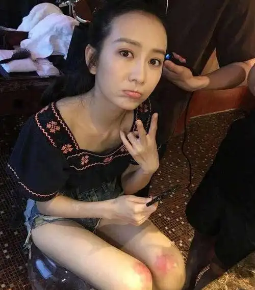 王鸥健身照曝光,健身房太用力,导致膝盖受伤,引发粉丝心疼