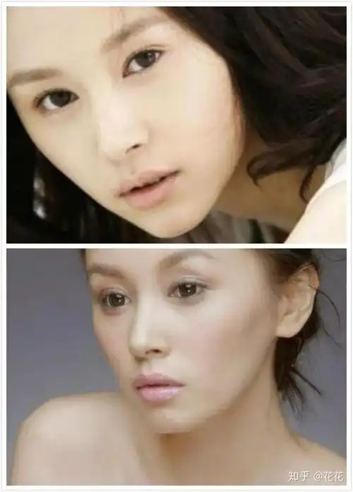 王子文是不是整形了?她现在长得好像杨幂和郑爽的混合体啊!