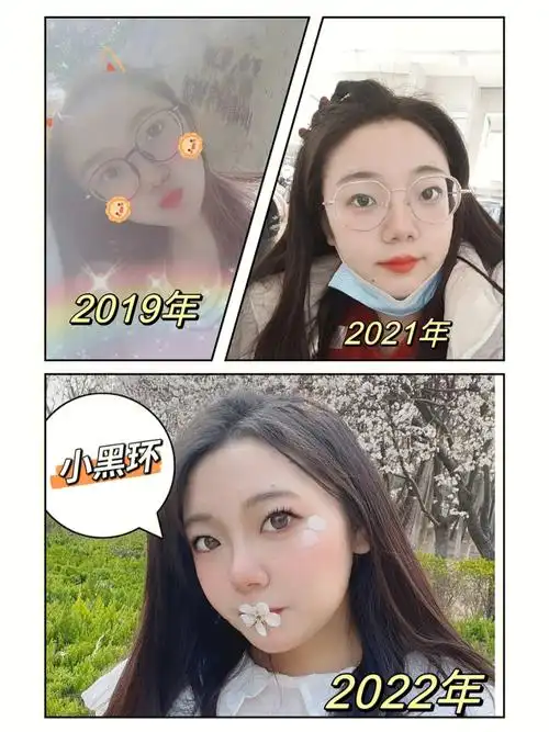 高度近视的人也爱美丽|近视1200度