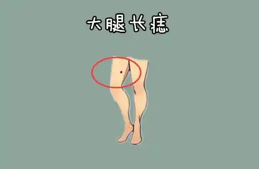 大腿根部有痣女人代表什么大腿根上长痣的女人旺夫运