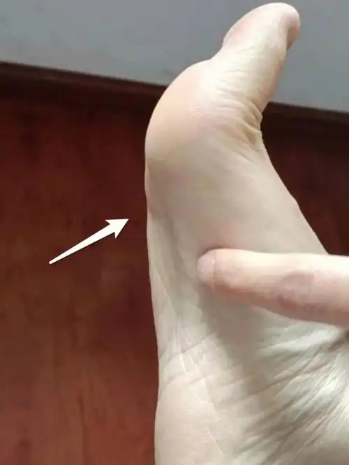 这样做脚底板就没有茧子喽