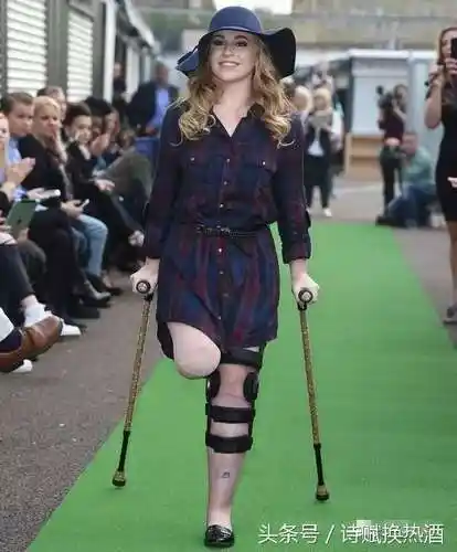 因脑膜炎被截肢失去双腿的她如何逆袭成超模