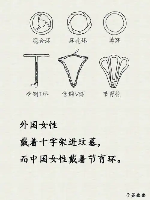 后来,节育环的种类越来越多.