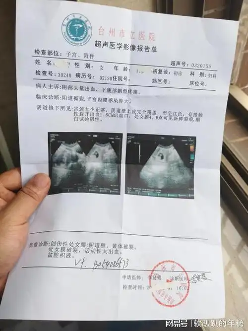 孕妇怀孕初期应保持心情舒畅避免经常出现焦虑恐惧紧张等情绪