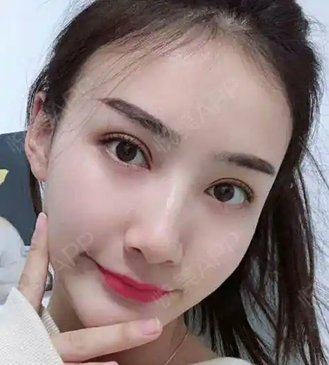 什么眼型割双眼皮好看,什么样的双眼皮类型最好看