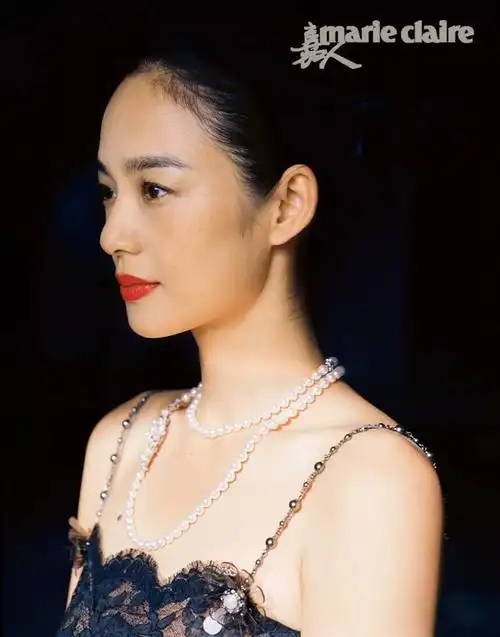 他们种植发际线的效果让我有点心动