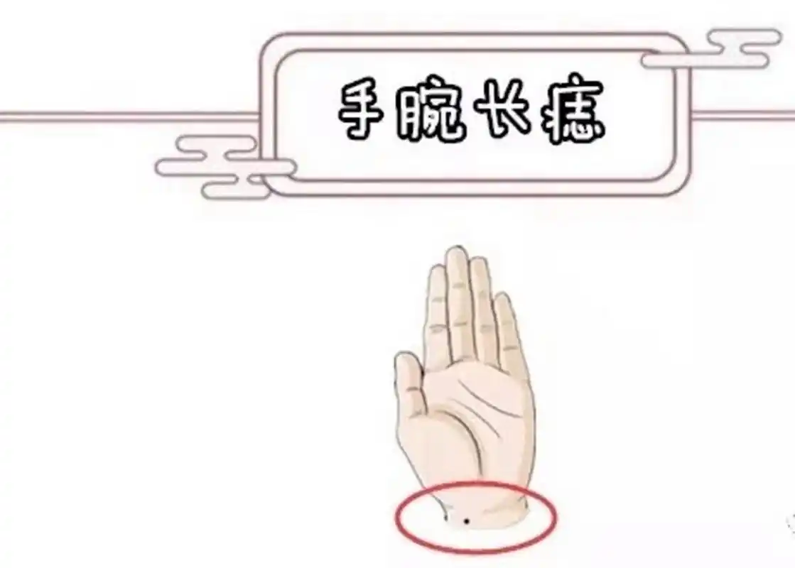 手腕长痣的意义