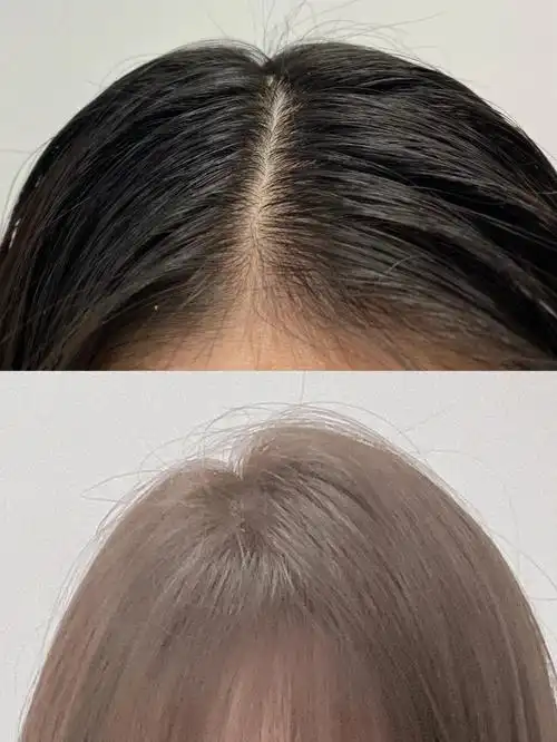 摩根烫发根蓬松立竿见影