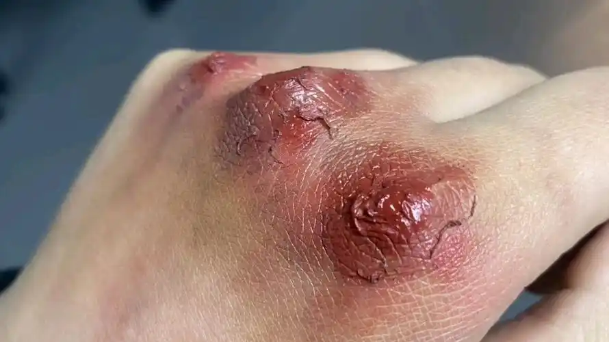 分享一款伤口妆,特效妆分享