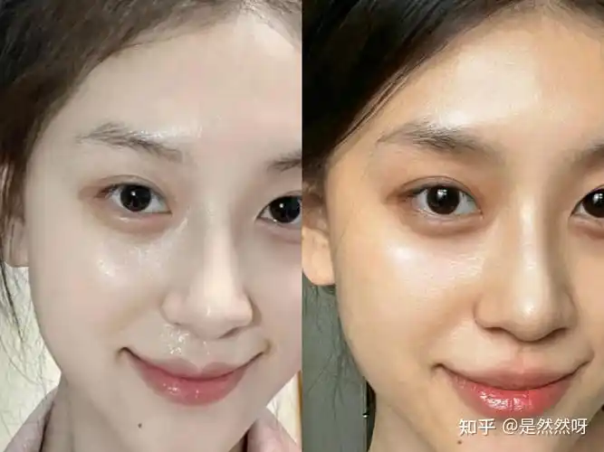 谷雨美白奶罐的美白实力真的不是吹的,才用了几个月,肤色和之前对比判