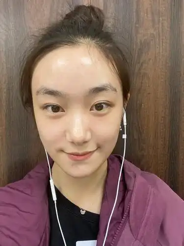 孙俪妹妹素颜怼脸自拍,发际线高像秃头脑门发光,网友:孙俪也秃