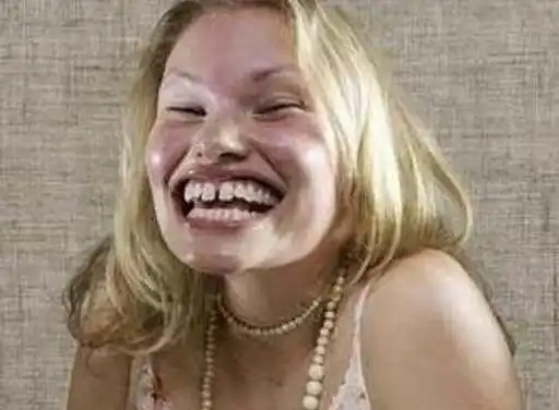 素颜丑女图片大全吓人 - 搜狗图片搜索