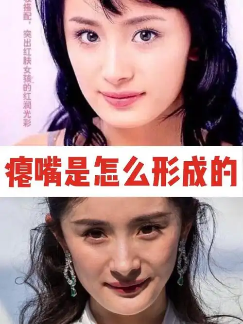 杨幂的嘴是怎么变瘪的