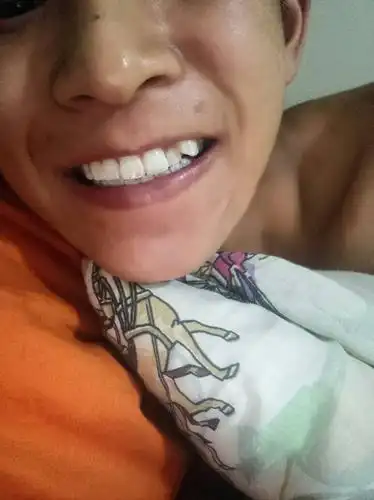 本人18岁,我这颗虎牙能不能修复或者是拔掉,对身体有没有危害性?