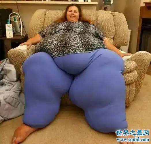 她被认为是地球上最重的女人,她把性行为的副作用归咎于她体重增加的