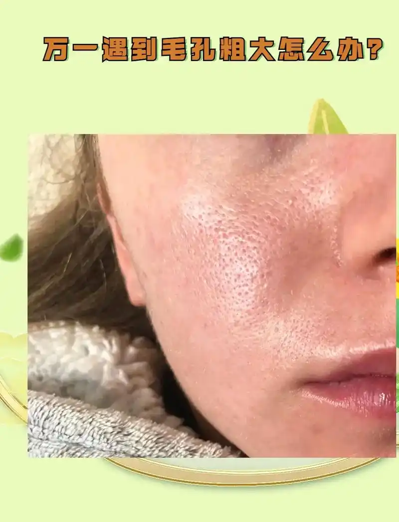 女生们看过来,为何你的毛孔粗大?我们都很想有好的皮肤,但是现 - 抖音