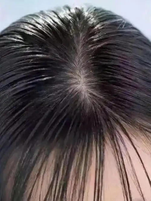 我的头发很爱出油,一天不洗就打绺.而且还容易发痒!